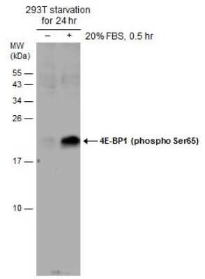 <b>Biological Strategies Validation and Genetic Strategies Validation.</b>Western Blot: 4EBP1 [p Ser65] Antibody [NBP3-13171] - Untreated (-) and treated (+) 293T whole cell extracts (60 ug) were separated by 15% SDS-PAGE, and the membrane was blotted with 4EBP1 (phospho Ser65) antibody (NBP3-13171) diluted at 1:500.